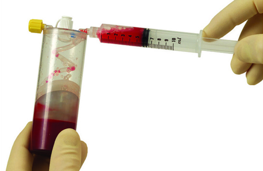 血液からPRP（多血小板血漿）を分離